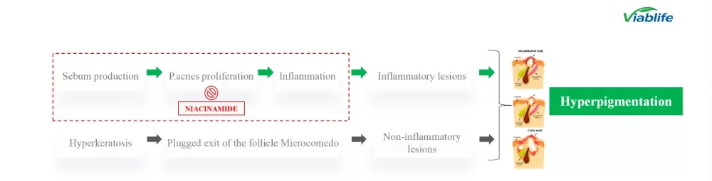 Nicotinamide dans les cosmétiques : contrôle efficace du sébum et suppression de l'acné