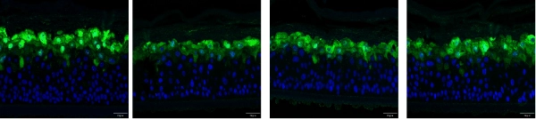 SLS-induced damaged 3D skin model