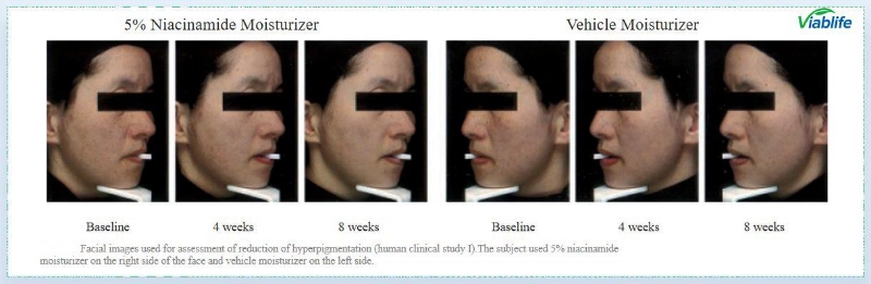 Nicotinamide pour éclaircir le teint Nicotinamide for Skin Brightening